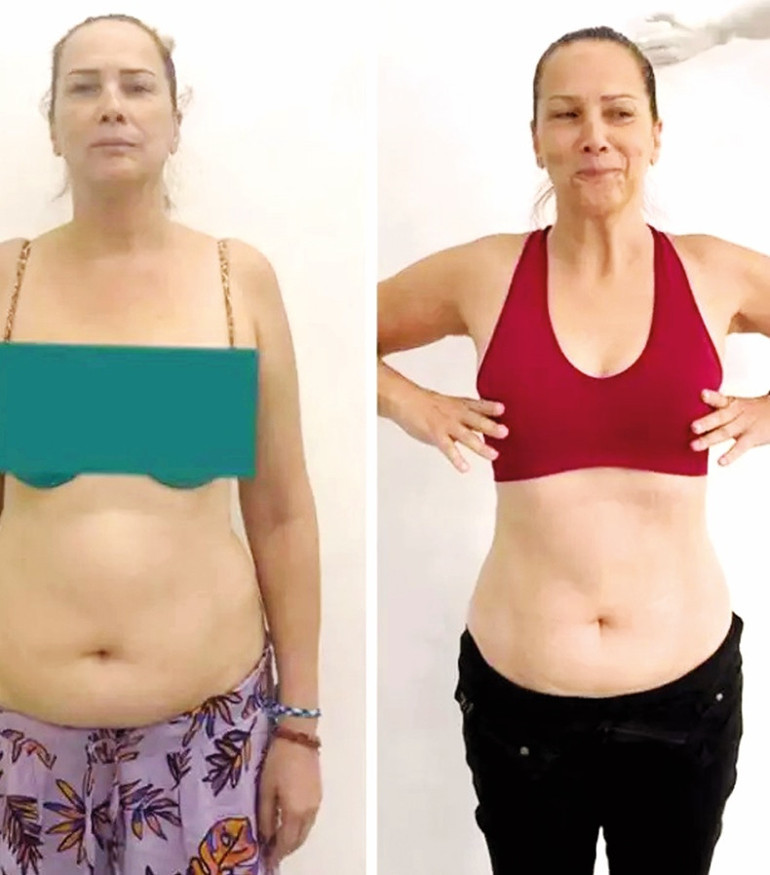 10 kilo veren Demet Akalın karın kaslarını sergiledi