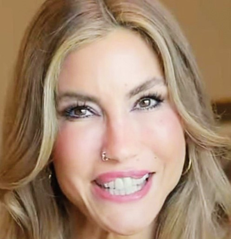 Yasemin Özilhandan estetik açıklaması: Sadece dudak dolgusu