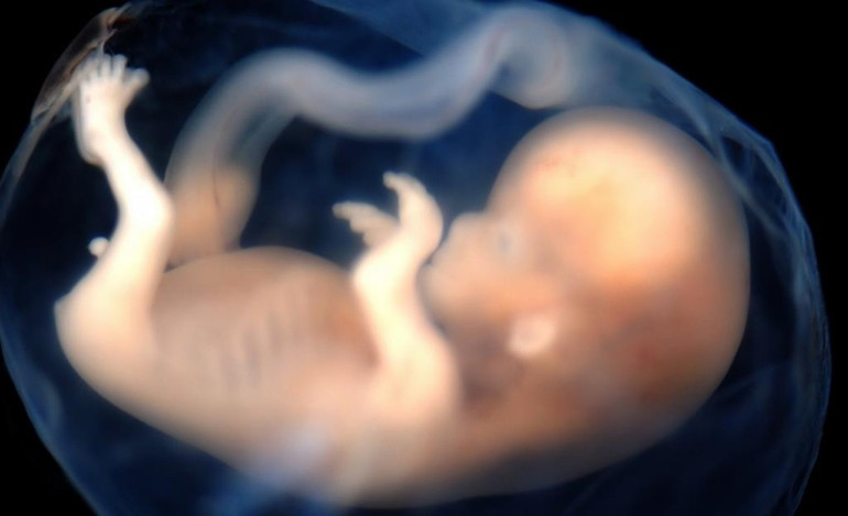 Gebelikte fetusda (bebekte) gelişme geriliği