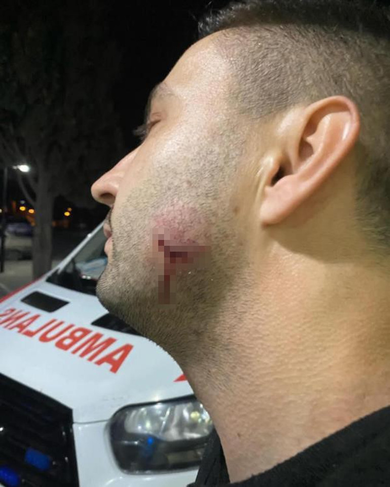 Tekirdağda uzman çavuş, sağlık çalışanını ısırdı Açığa alındı... Görüntüler ortaya çıktı