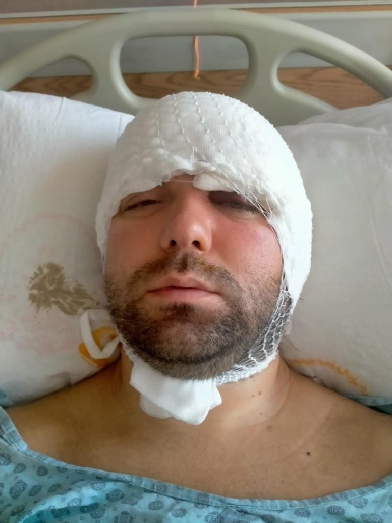 İmplant tedavisinde kan donduran olay İşlemi eliyle yapınca vida hastanın beynine saplandı... Beni hastaneye bırakıp kaçtı