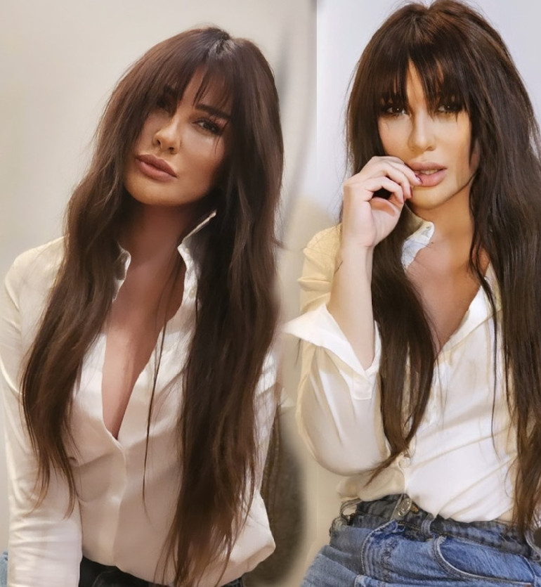 Yasemin Özilhandan estetik açıklaması: Sadece dudak dolgusu