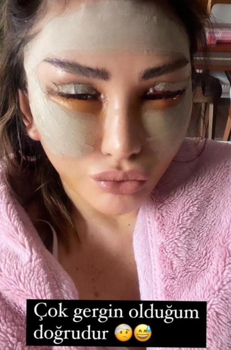 Yasemin Özilhandan estetik açıklaması: Sadece dudak dolgusu