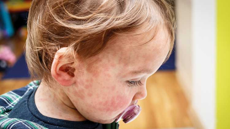 Sağlık Bakanlığı aileleri uyardı