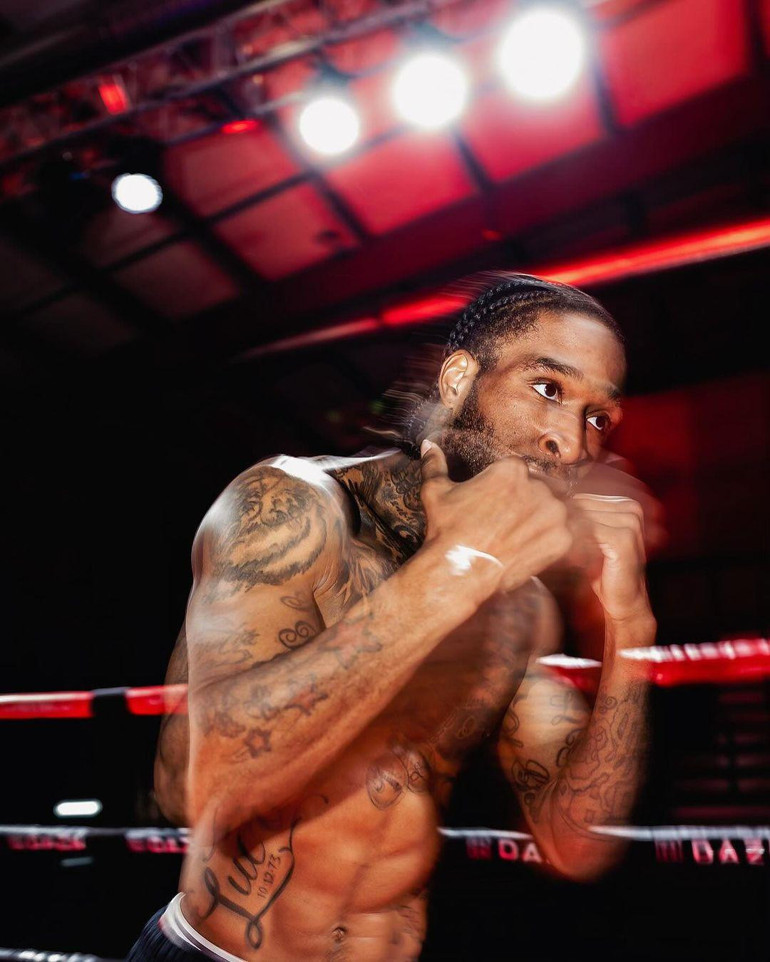 Aaron Boupendzaya gece kulübünde boksör dayağı Çenesi kırıldı, 2 ay yok