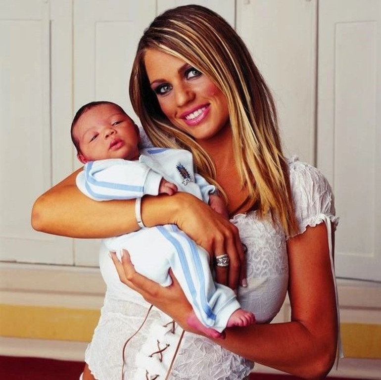 Estetik bağımlısı yıldız bu uğurda servetinden oldu… Onu kimse durduramıyor: Oyuncak bebek gibi olana kadar devam