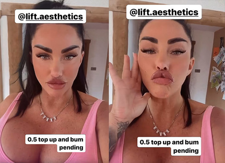 Estetik bağımlısı yıldız bu uğurda servetinden oldu… Onu kimse durduramıyor: Oyuncak bebek gibi olana kadar devam