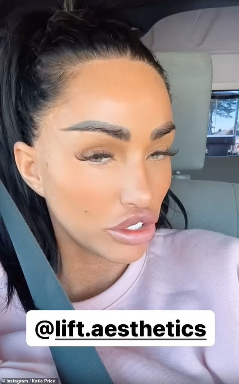 Estetik bağımlısı yıldız bu uğurda servetinden oldu… Onu kimse durduramıyor: Oyuncak bebek gibi olana kadar devam