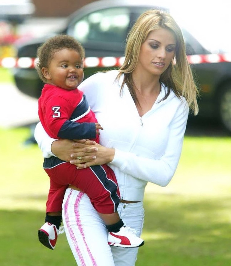 Estetik bağımlısı yıldız bu uğurda servetinden oldu… Onu kimse durduramıyor: Oyuncak bebek gibi olana kadar devam