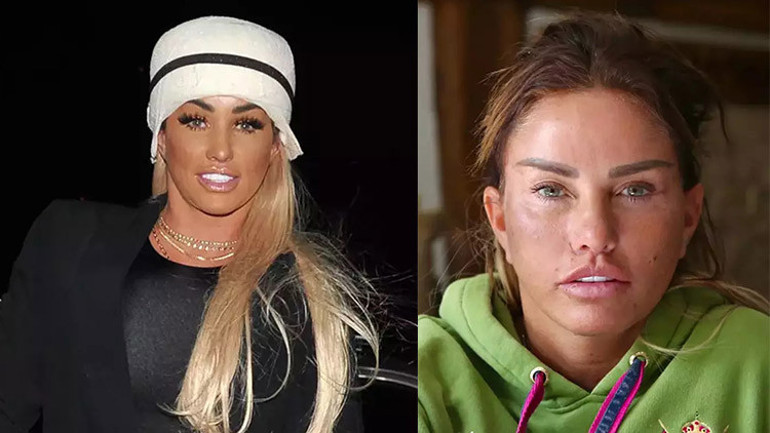 Estetik bağımlısı yıldız bu uğurda servetinden oldu… Onu kimse durduramıyor: Oyuncak bebek gibi olana kadar devam