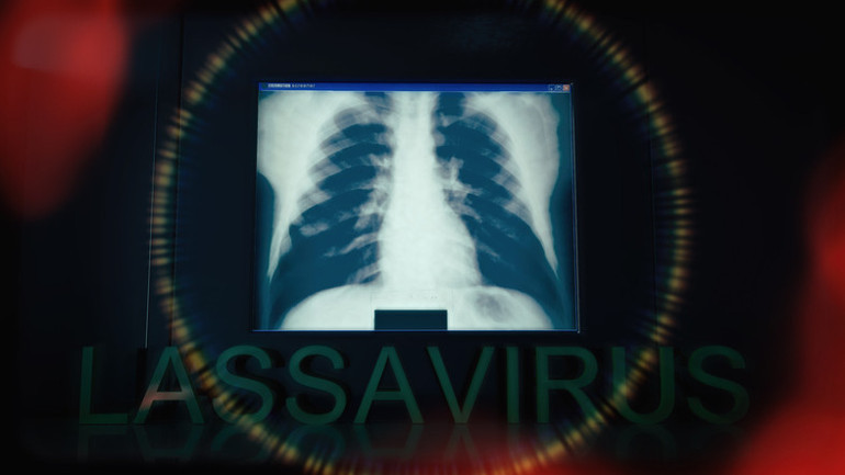 Gözlerde ve kulaklarda kanamaya neden olan virüs Fransada Yetkililer temaslı kişilerin peşine düştü