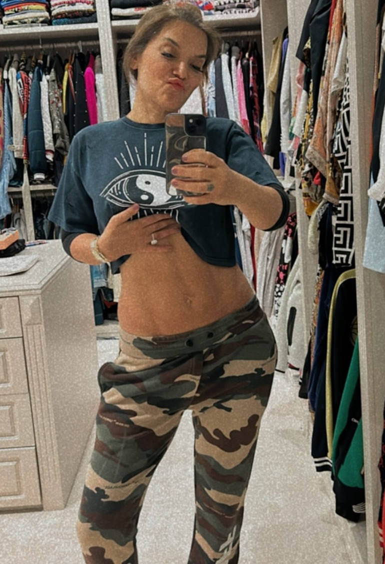 10 kilo veren Demet Akalın karın kaslarını sergiledi