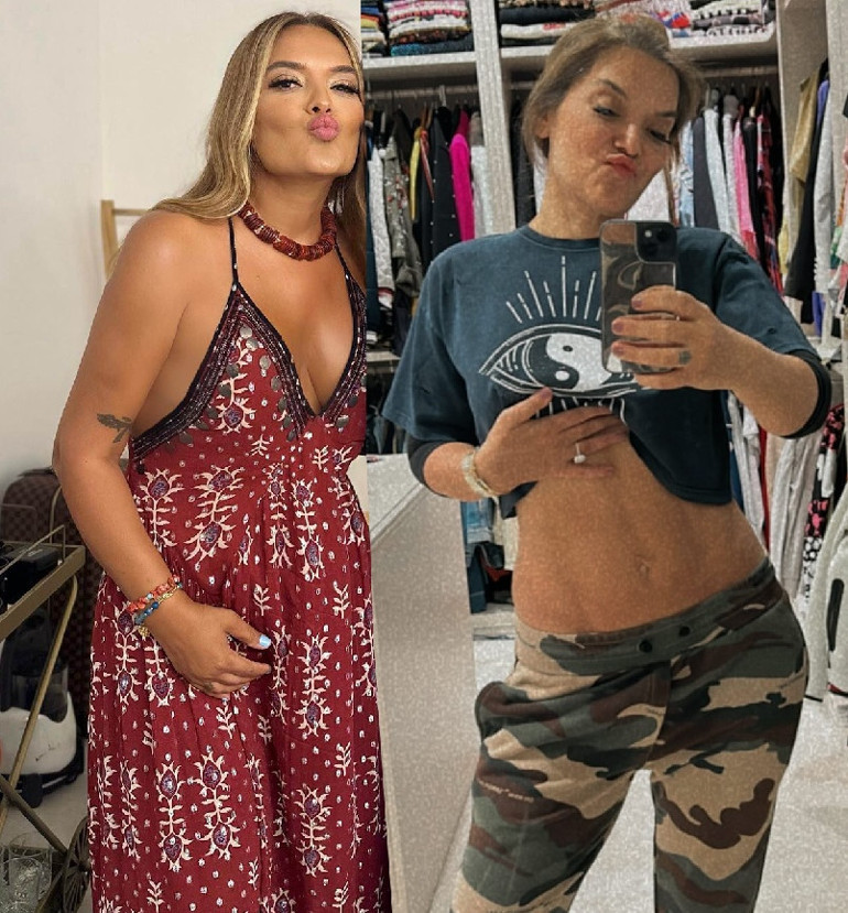 10 kilo veren Demet Akalın karın kaslarını sergiledi