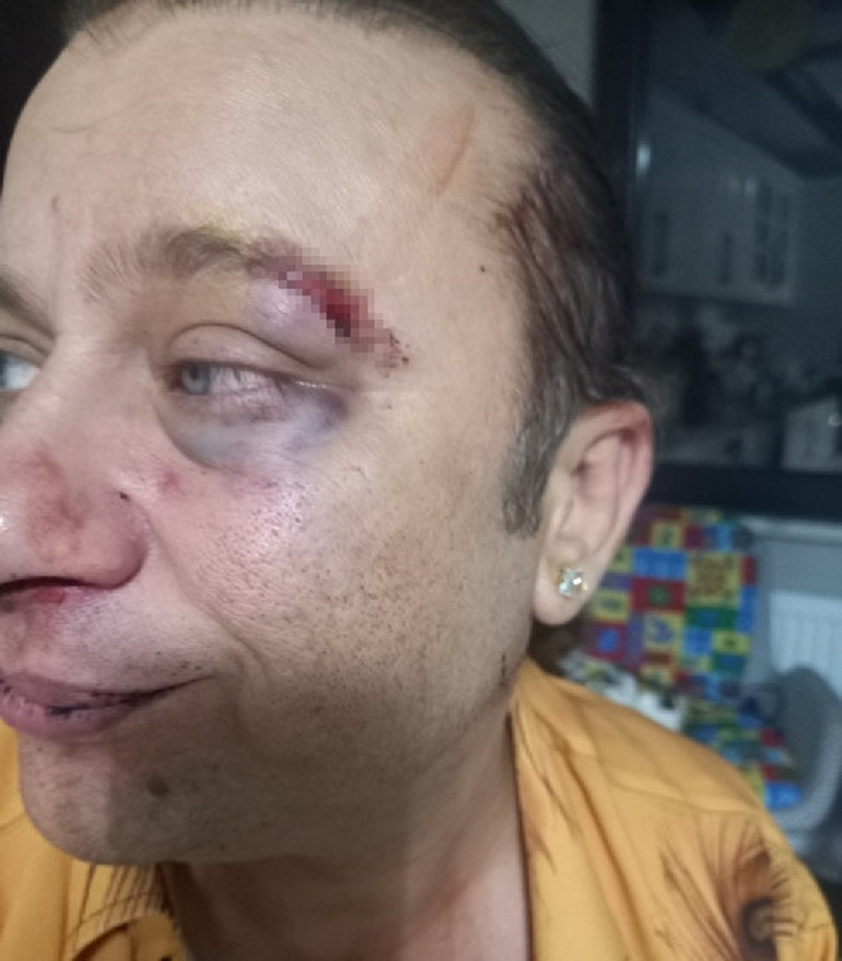 ‘Kadir Doğulu için’ dedi vurdu