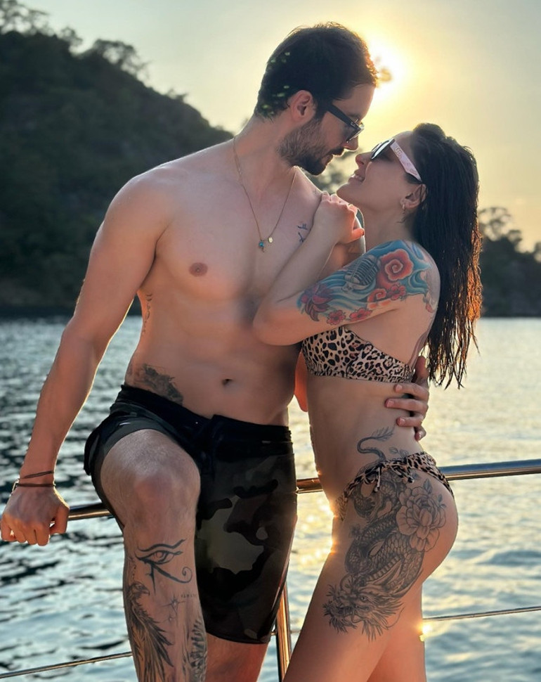 Herkes rahatlasın arkadaşlar. Evet, ben de o estetiği yaptırdım