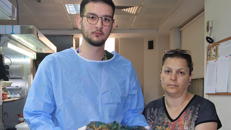 Karın ağrısı şikayetiyle gitti, doktorun verdiği cevapla şaşkına döndü Çok nadir göreceğimiz bir vaka