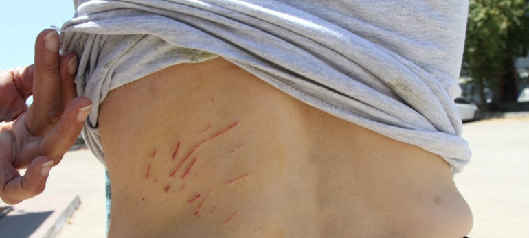 Kedi saldırısında neye uğradığını şaşırdı Kaplan gibi atladı Ben artık korkuyorum