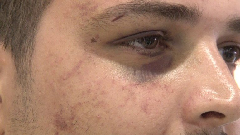 Saraybosnada fidye için kaçırılan Türk yaşadığı dehşeti anlattı: Dağları aştık, 4 bin euro ödedik