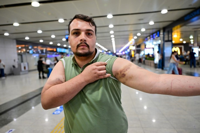 Saraybosnada fidye için kaçırılan Türk yaşadığı dehşeti anlattı: Dağları aştık, 4 bin euro ödedik