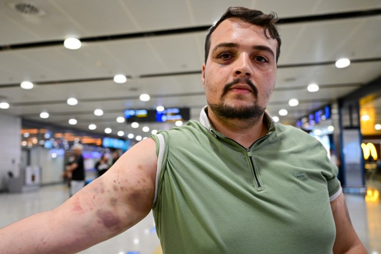 Saraybosnada fidye için kaçırılan Türk yaşadığı dehşeti anlattı: Dağları aştık, 4 bin euro ödedik