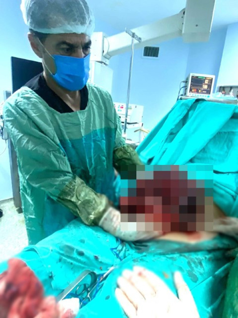 Karın ağrısı şikayetiyle hastaneye gidince ortaya çıktı Yıllarca vücudunda taşımış: Tam 10 kilo... Ameliyatla alındı