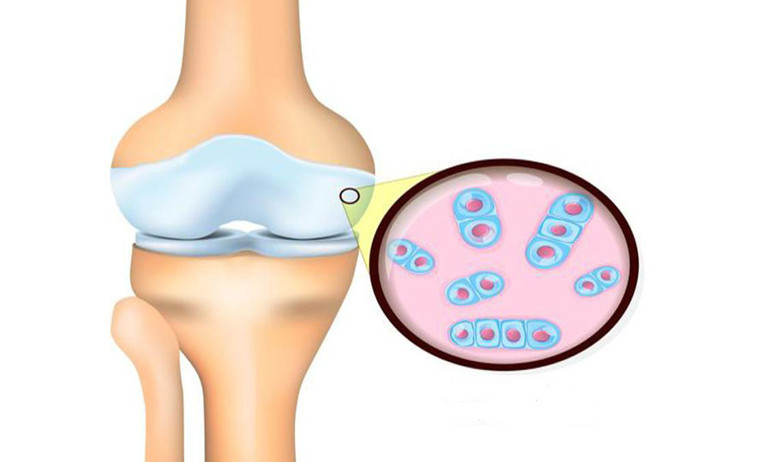 Kuyruk yağı, kantaron yağı, kolajen takviyeleri diz ağrılarına iyi gelir mi