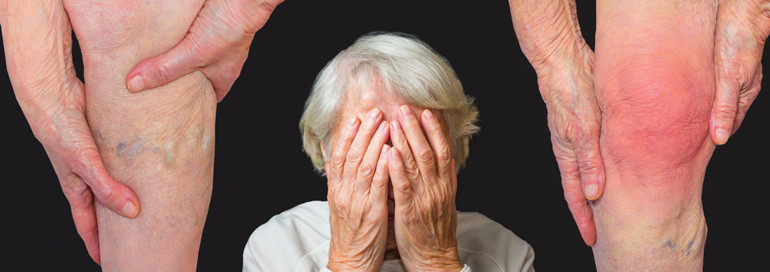 Kuyruk yağı, kantaron yağı, kolajen takviyeleri diz ağrılarına iyi gelir mi