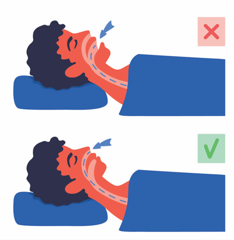 Binlerce insan böyle uyuyor | Ağız bantları gerçekten uykuya dalmayı kolaylaştırıyor mu Boğulma riski var mı