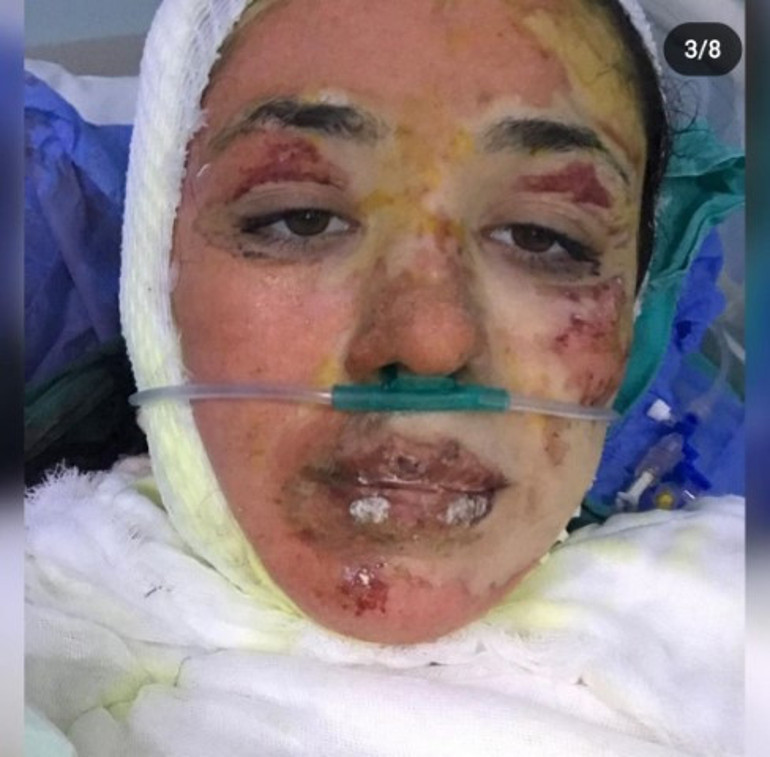 Hastanedeki patlamaya hemşire neden olmuş... Yakayım mı sizi, deyip çakmağı çaktı... Abi yapma dedim dinlemedi