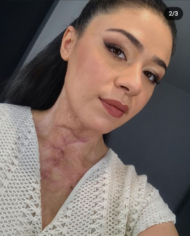 Hastanedeki patlamaya hemşire neden olmuş... Yakayım mı sizi, deyip çakmağı çaktı... Abi yapma dedim dinlemedi