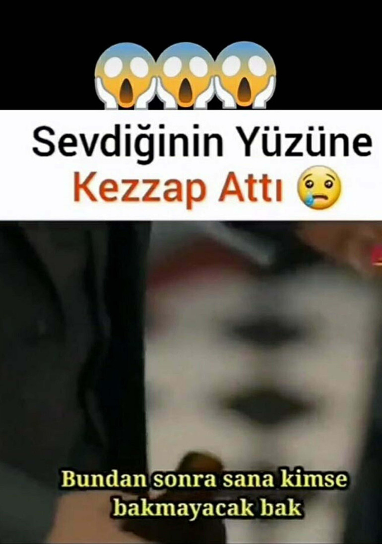 Masaj salonunda kadın çalışanın yüzüne kezzap attı