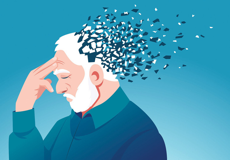 Dünyada her yıl 10 milyon yeni vaka Eylül, Alzheimer farkındalık ayı... A’dan Z’ye alzheimer