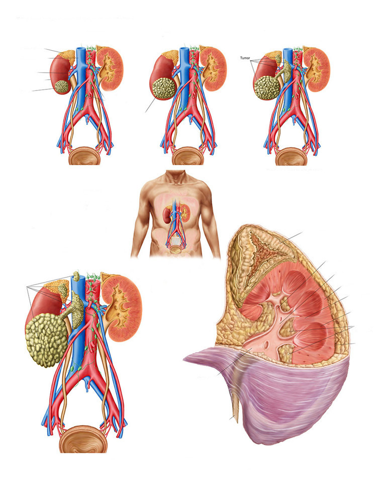 Ünlü fenomen 25 yaşında addison hastalığından hayatını kaybetti