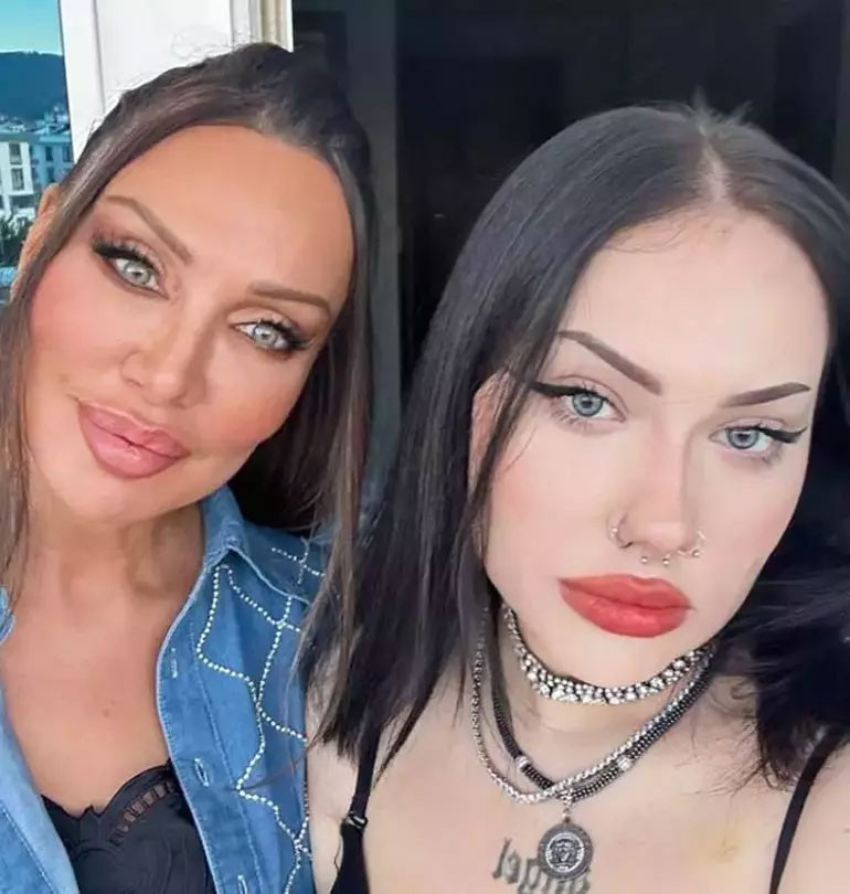 Ünlü şarkıcı Umut Akyürekin yardım çığlığı: Kızım bağımlı dedi, Melek Bal kelepçeli fotoğrafını paylaştı