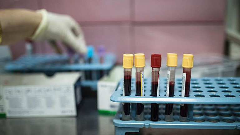 Gıda alerjisi sanıldı: 15 yaşındaki çocuk kanser hastası çıktı