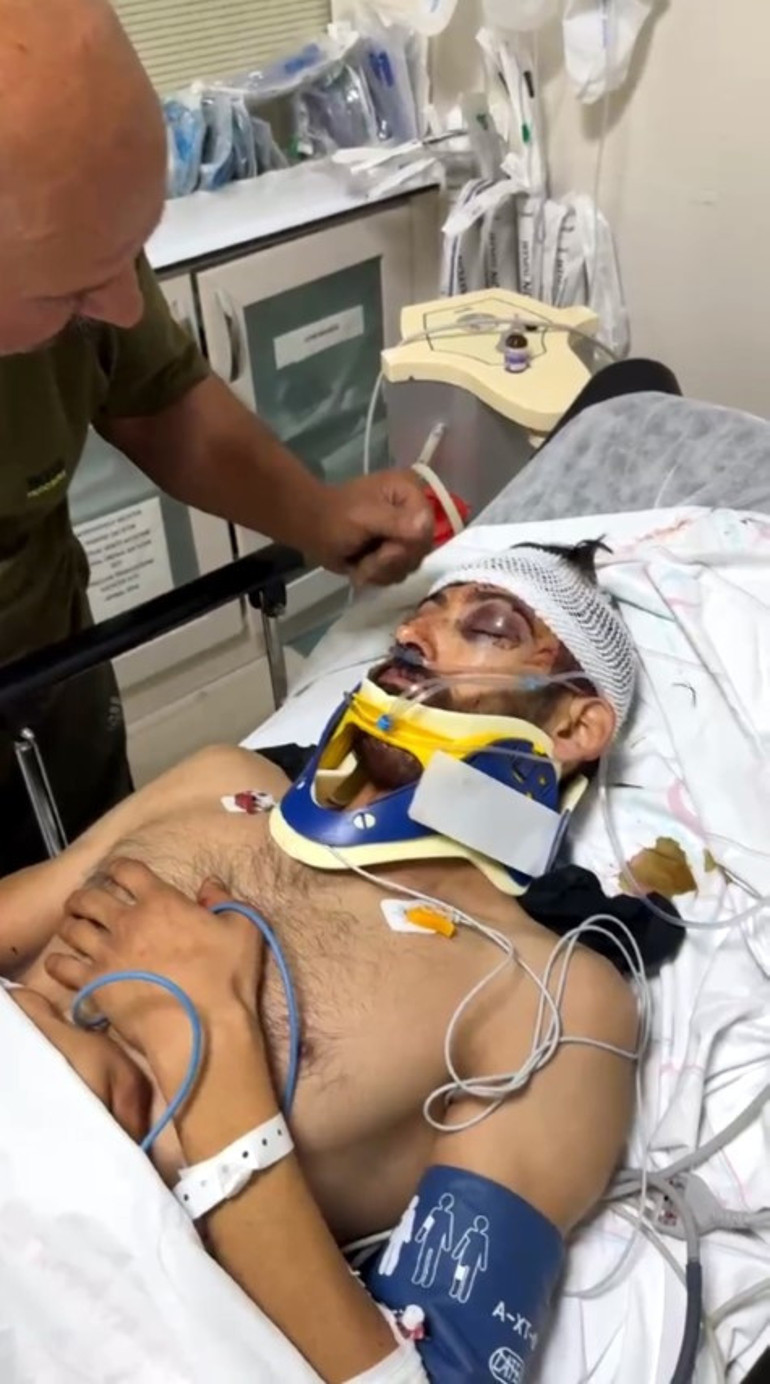 Eşinin fotoğrafını görünce tek yumrukla komaya sokmuştu: Saldırıya uğrayan gençten acı haber
