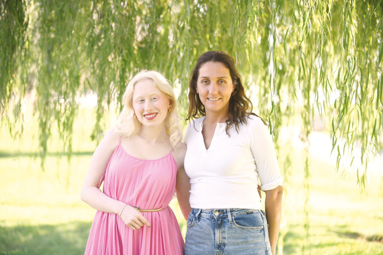 ‘Albinizmi fırsata çevirmenin yollarını anlatıyorum’