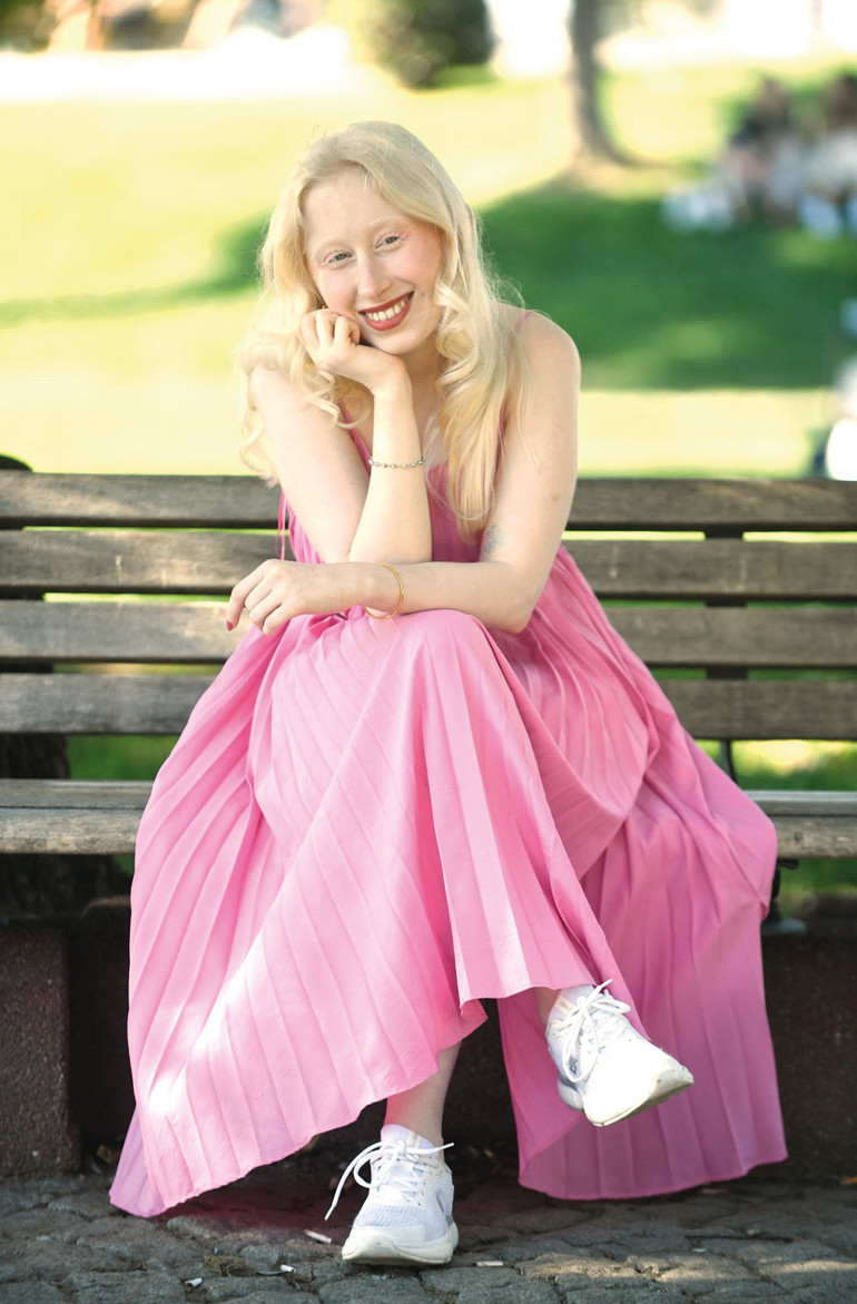 ‘Albinizmi fırsata çevirmenin yollarını anlatıyorum’