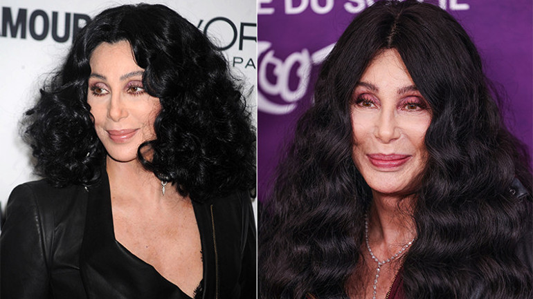 Kendinden 40 yaş küçük sevgilisiyle büyük bir aşk yaşıyor… En sonunda güneş ışığına bile düşman oldu… ‘Tıpkı bir vampire döndü’