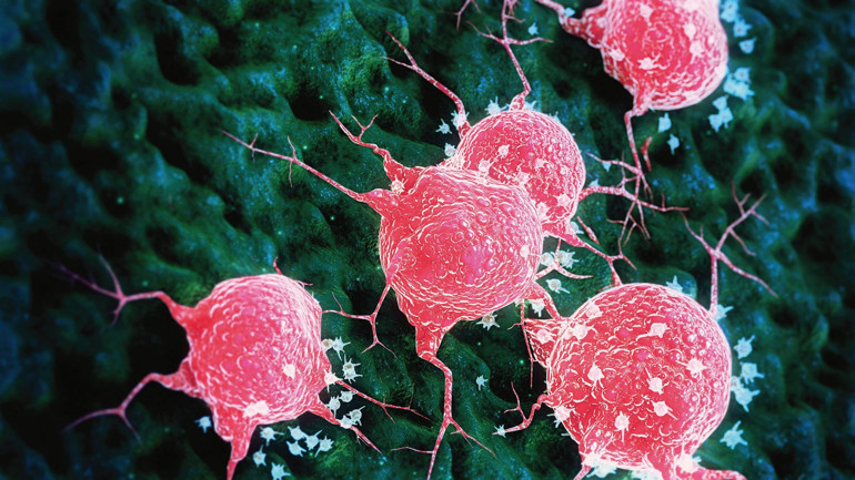 Sinsi bir hastalık ama hayatta kalma oranları artıyor