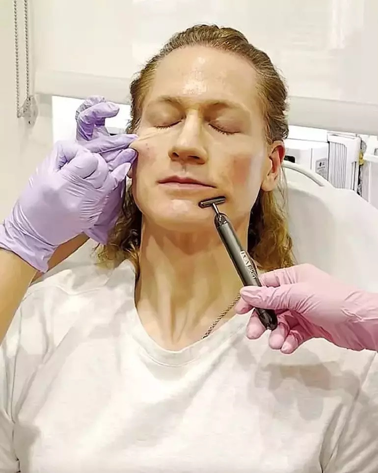 Tüm servetini genç kalmak için harcıyor… ‘Vampir milyoner’ tanınmayacak hale geldi