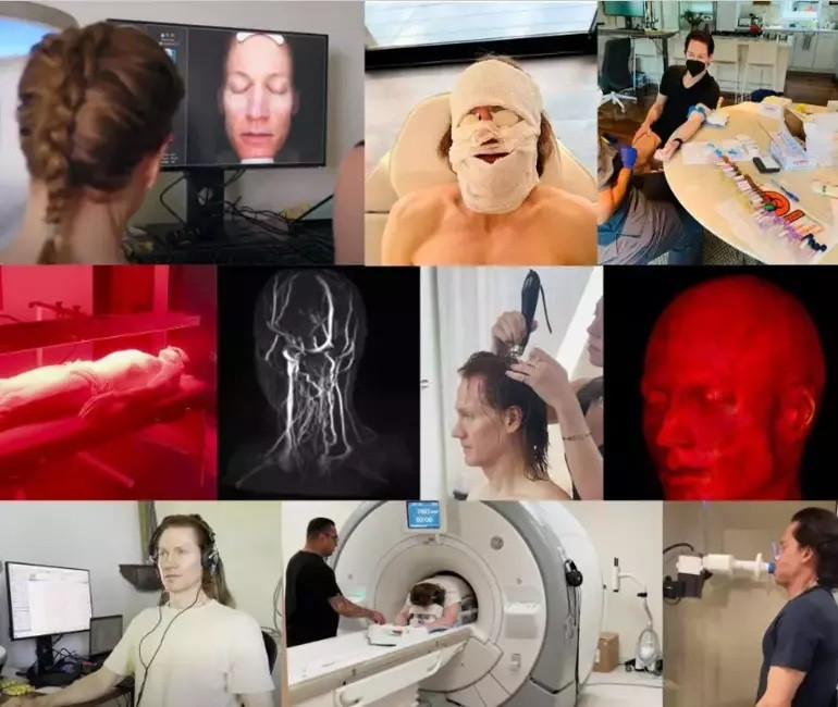 Tüm servetini genç kalmak için harcıyor… ‘Vampir milyoner’ tanınmayacak hale geldi