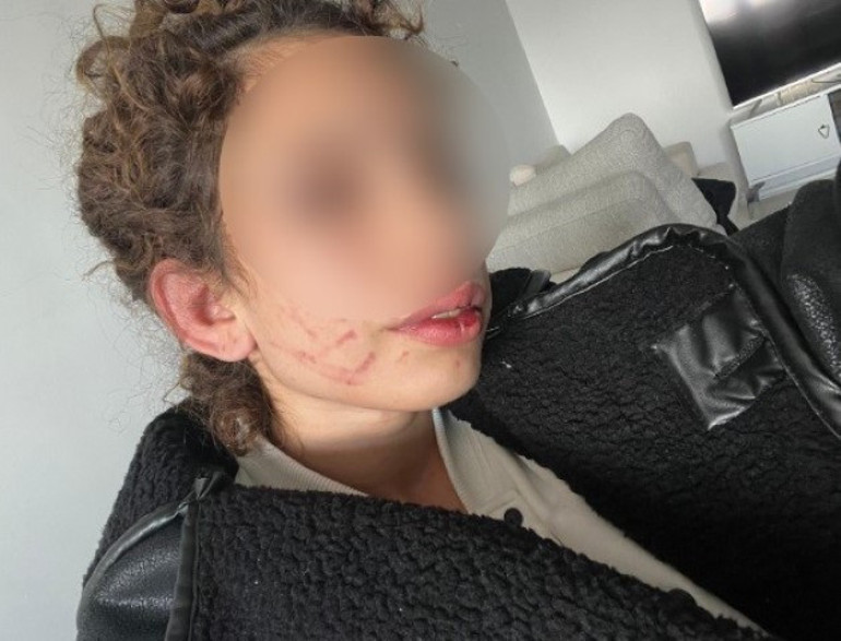 Konyada kız arkadaşına dehşeti yaşatmıştı Sevgiliden yüzsüz savunma: Kendi kendini yaraladı