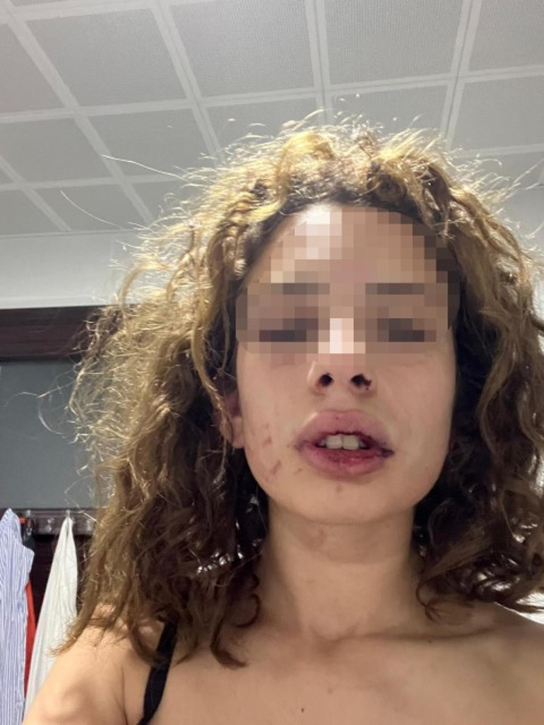 Konyada kız arkadaşına dehşeti yaşatmıştı Sevgiliden yüzsüz savunma: Kendi kendini yaraladı