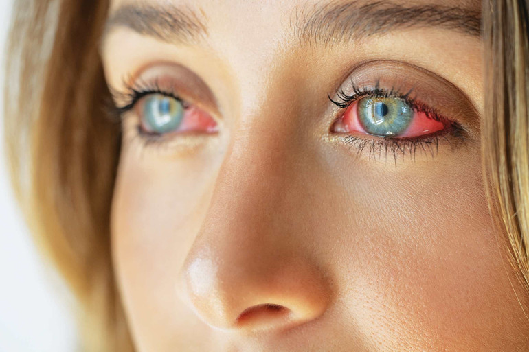 Kaşımak ve kaşımamak, işte bütün mesele...