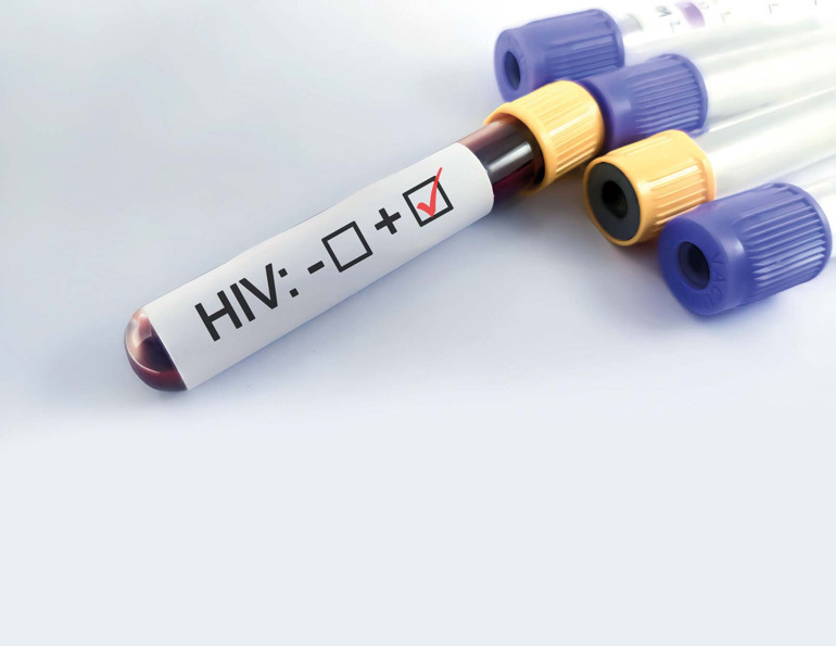 HIV artıyor neden saklıyoruz
