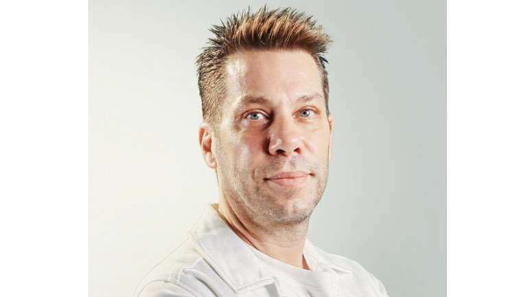 Kaşı yarıldı kendini yere atmadı... Dzeko duruşu örnek olsun