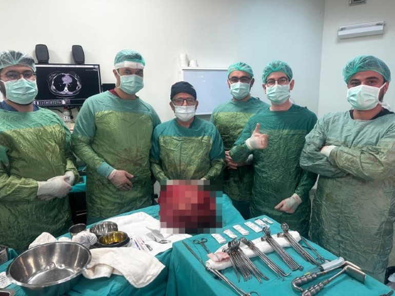 Karnındaki şişlik için hastaneye gitti, gerçeği öğrenince büyük şok yaşadı Doktorlar gözlerine inanamadı: Tüm organlar ile iç içeydi