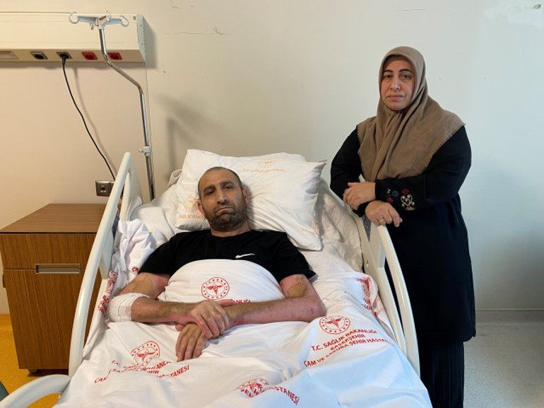 Mangal yapmak isterken dehşeti yaşadı Vücudunun yüzde 80i yandı