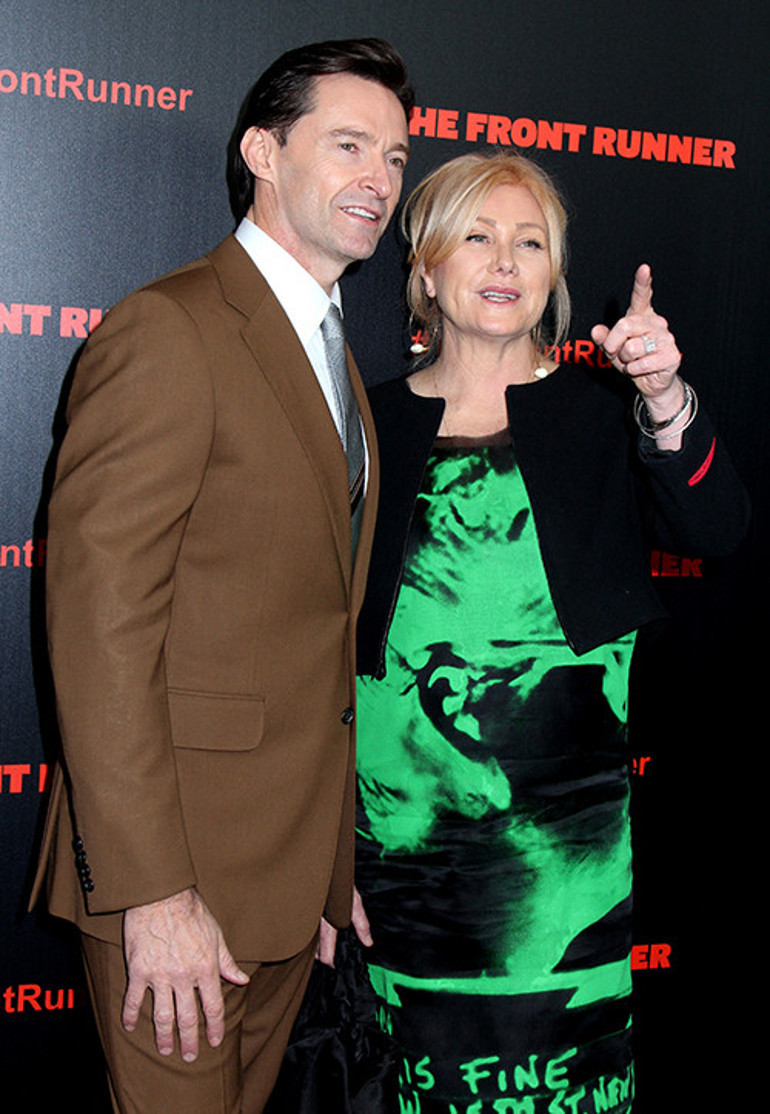 Aylarca insan içine bile çıkamamışlardı...  Ünlü aşıklar dudak dudağa